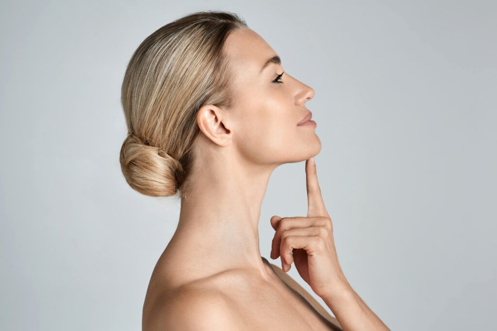 Side profile of a woman with a sculpted jawline after Kybella treatment.