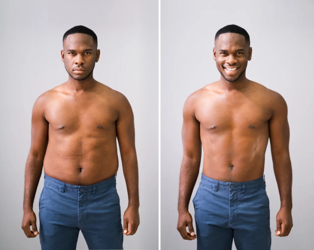 A before-and-after transformation of a man who achieved significant fat loss through medical weight loss.